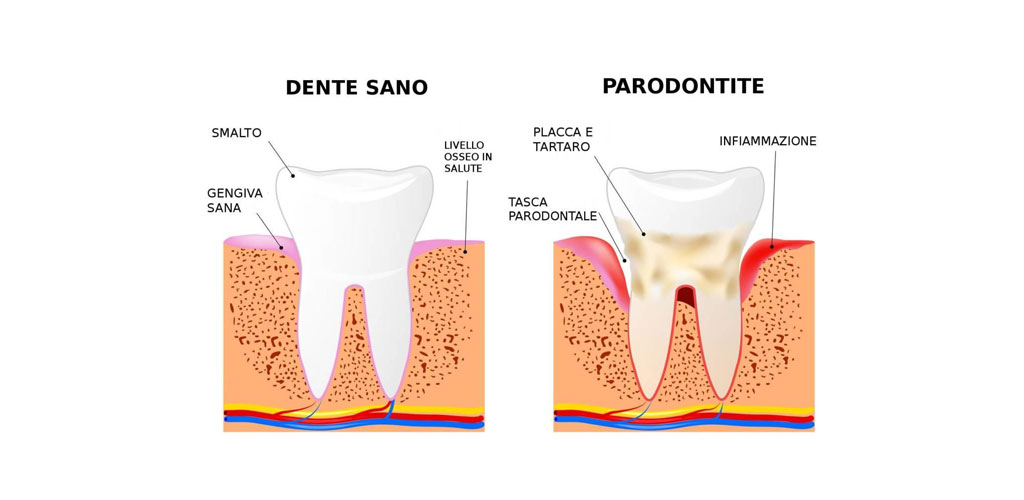 parodontologia san severo